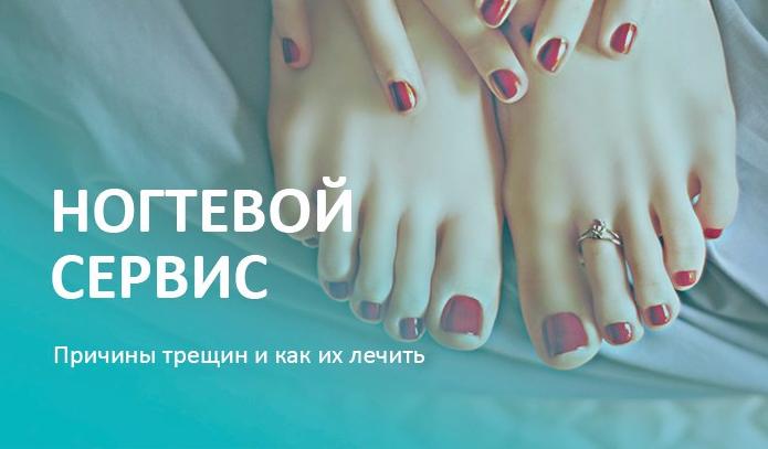 Причины трещин и как их лечить